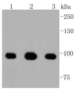 ATP citrate lyase Rabbit mAb