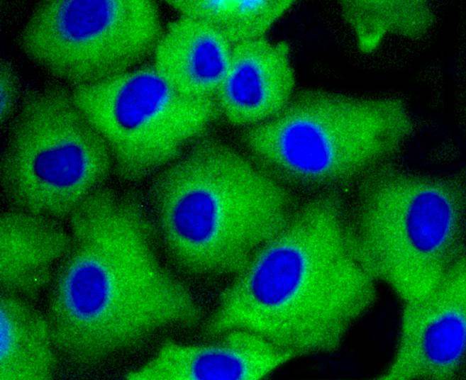 beta Arrestin 1 Rabbit mAb