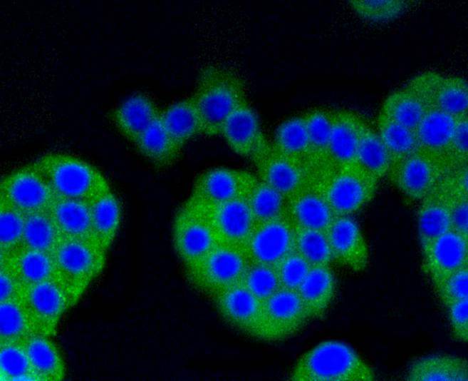 beta Arrestin 1 Rabbit mAb