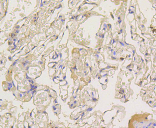 beta Arrestin 1 Rabbit mAb