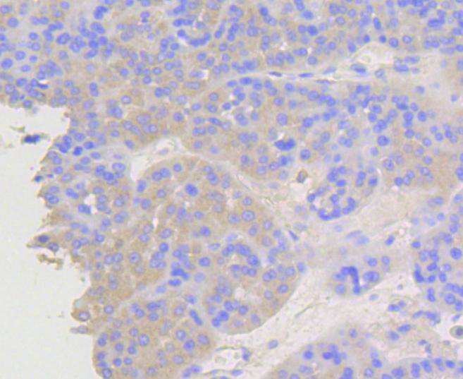 beta Arrestin 1 Rabbit mAb