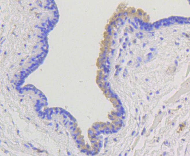 beta Arrestin 1 Rabbit mAb