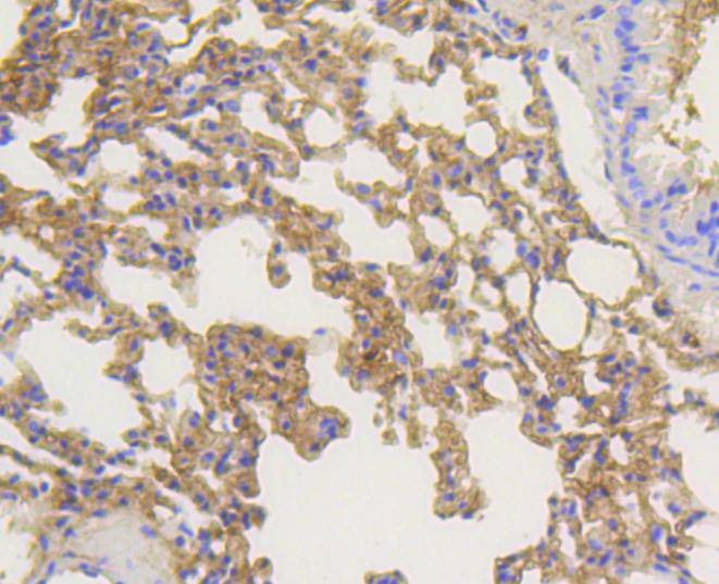 beta Arrestin 1 Rabbit mAb