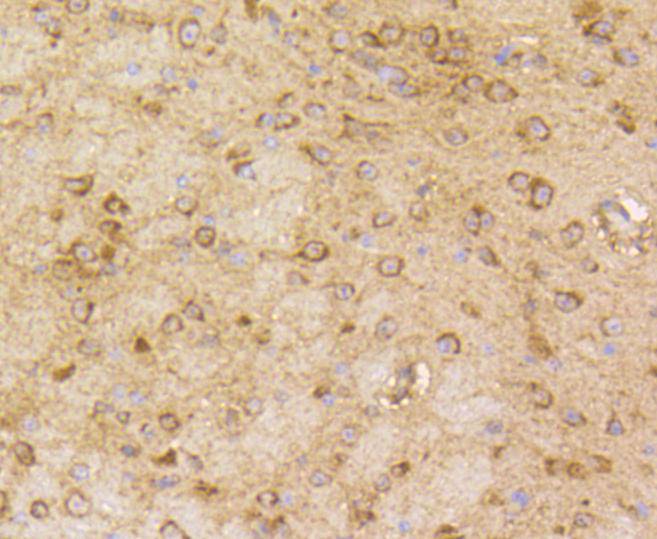 beta Arrestin 1 Rabbit mAb