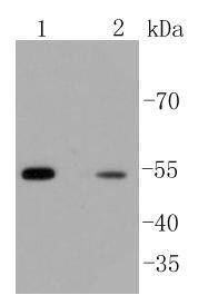 beta Arrestin 1 Rabbit mAb