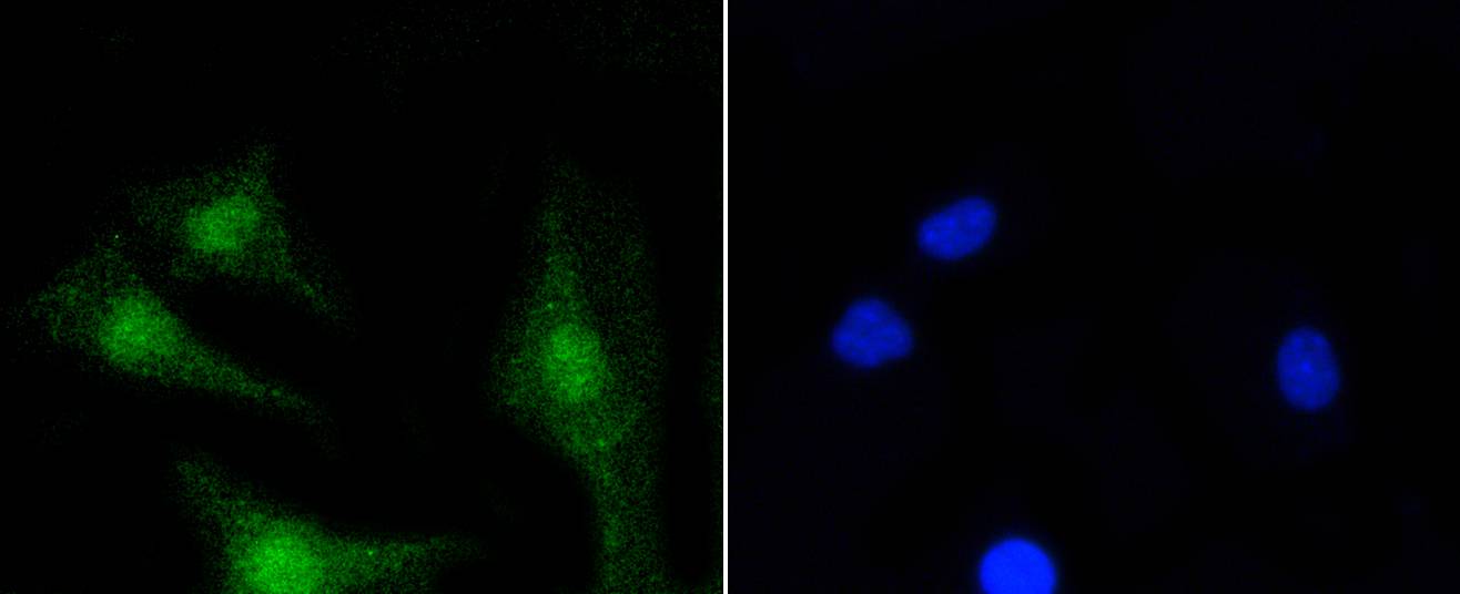 PKC beta 2 Rabbit mAb