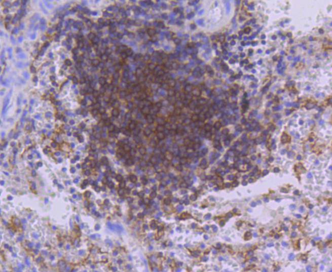 PKC beta 2 Rabbit mAb