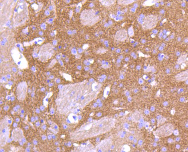 PKC beta 2 Rabbit mAb