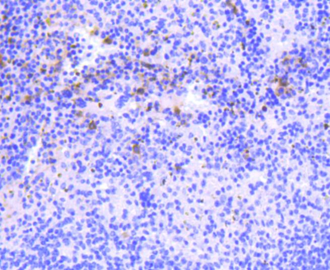 PKC beta 2 Rabbit mAb