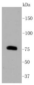 PKC beta 2 Rabbit mAb