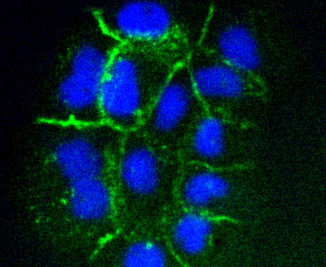 ICAM1 Rabbit mAb