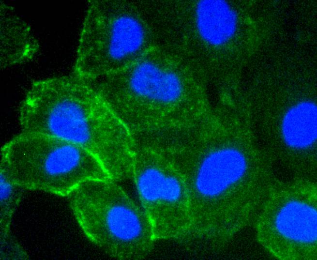 ICAM1 Rabbit mAb