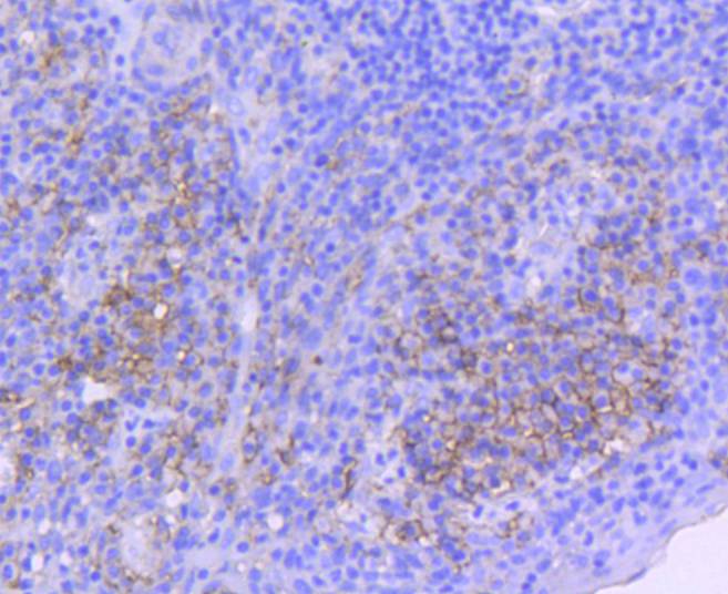 ICAM1 Rabbit mAb