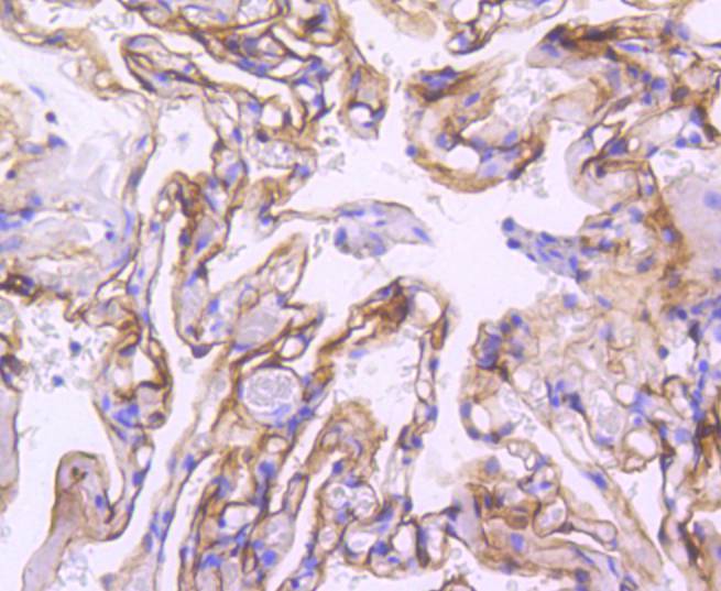 ICAM1 Rabbit mAb