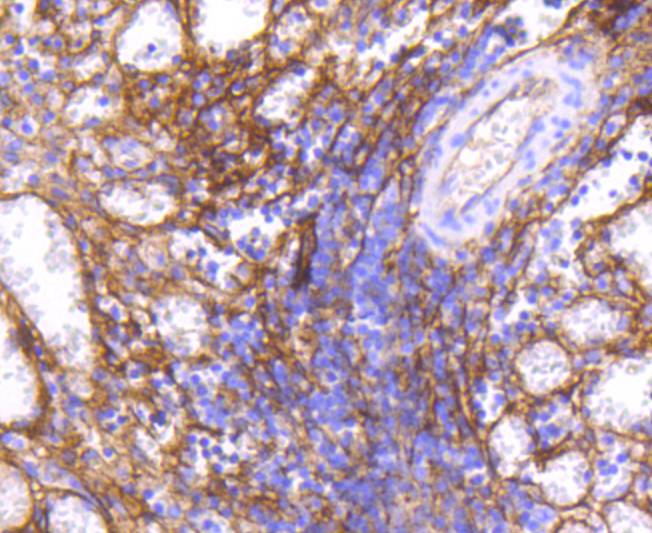 ICAM1 Rabbit mAb