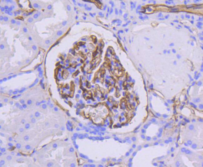 ICAM1 Rabbit mAb