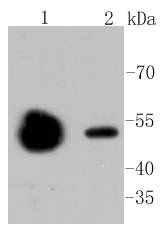 beta Ⅱ Tubulin Rabbit mAb