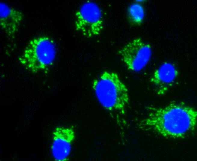 AKT1/2/3 Rabbit mAb