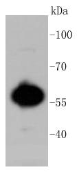 AKT1/2/3 Rabbit mAb