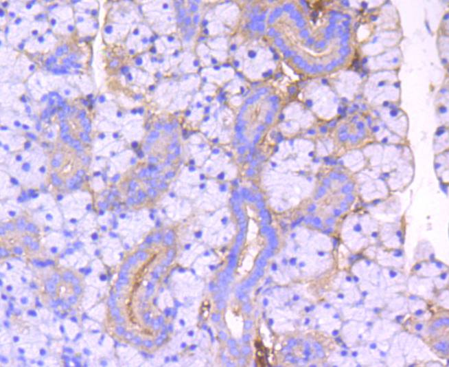 ROCK1 Rabbit mAb