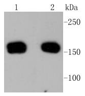 ROCK1 Rabbit mAb