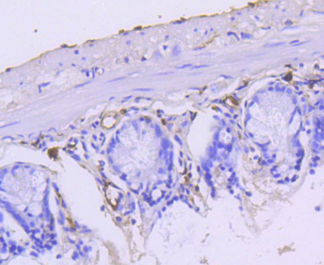 Cytokeratin 15 Rabbit mAb