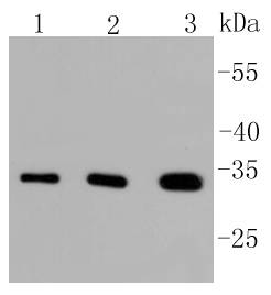 PIM1 Rabbit mAb