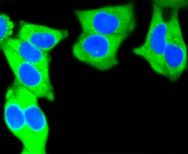 Cytokeratin 7 Rabbit mAb