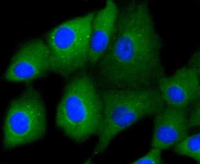 Cytokeratin 7 Rabbit mAb