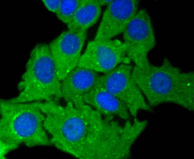 Cytokeratin 7 Rabbit mAb