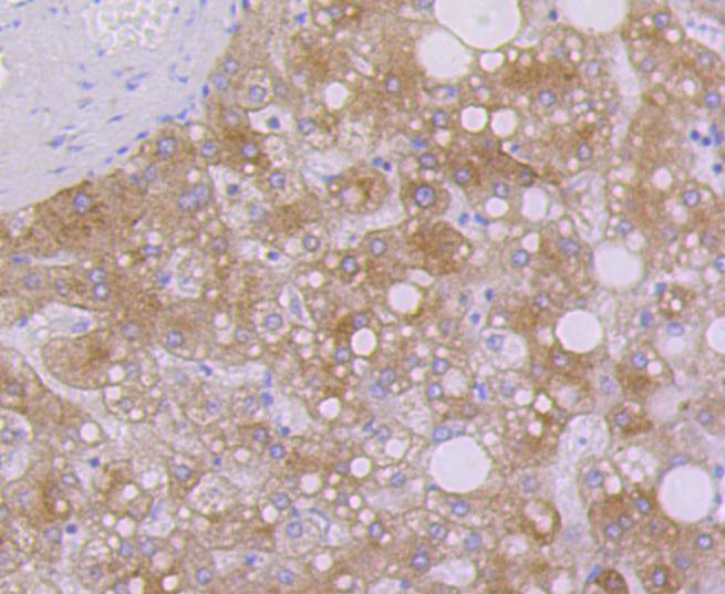 Cytokeratin 7 Rabbit mAb