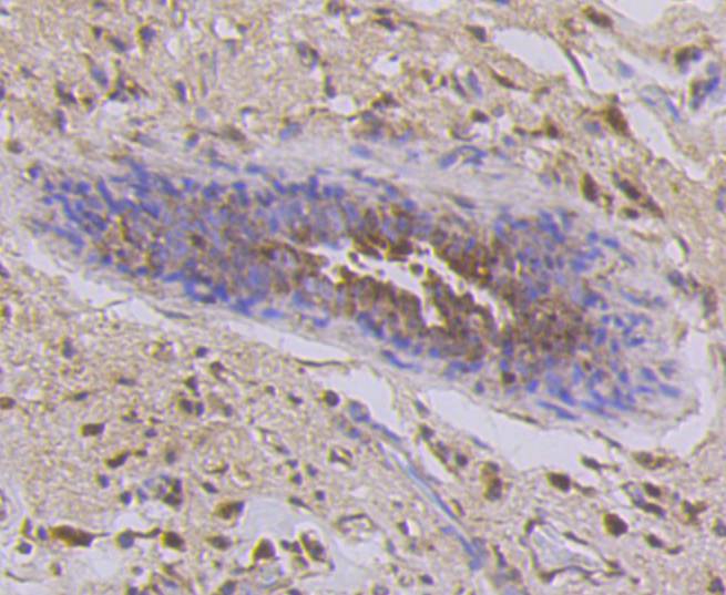 Cytokeratin 7 Rabbit mAb