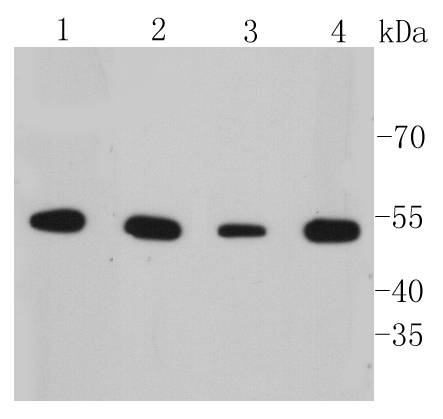 Cytokeratin 7 Rabbit mAb