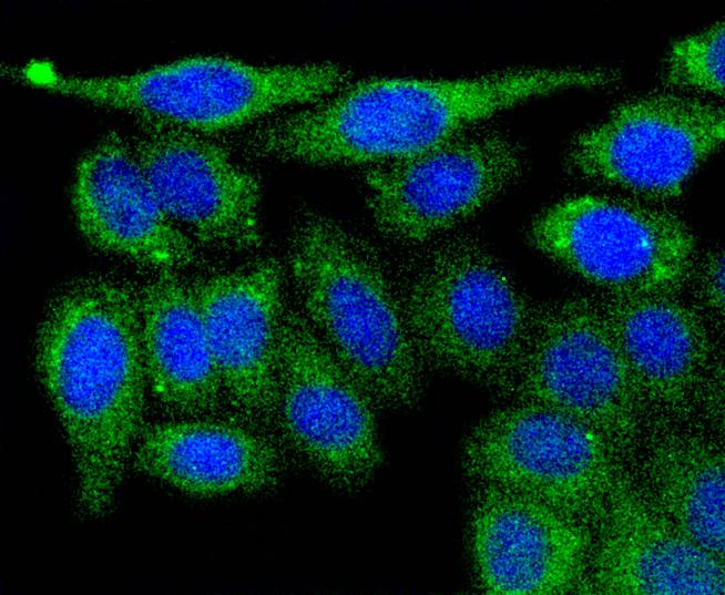 PGK1 Rabbit mAb