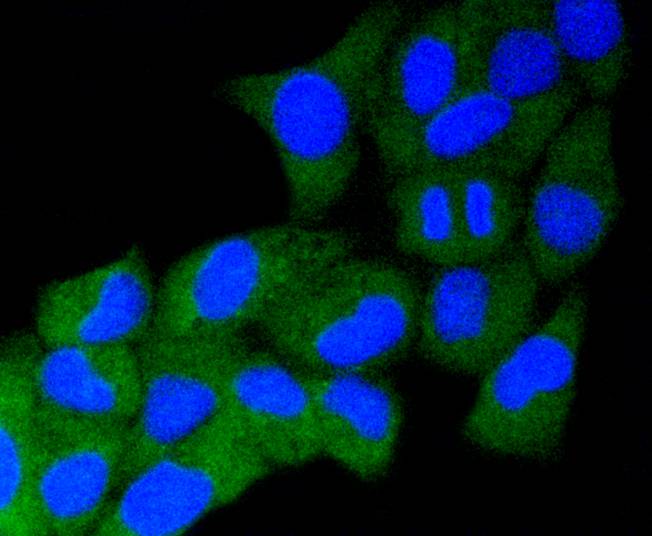 alpha+beta Synuclein Rabbit mAb