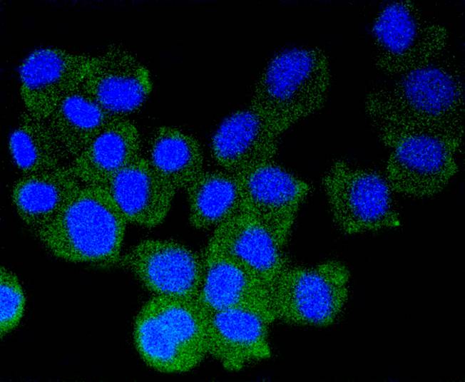 alpha+beta Synuclein Rabbit mAb