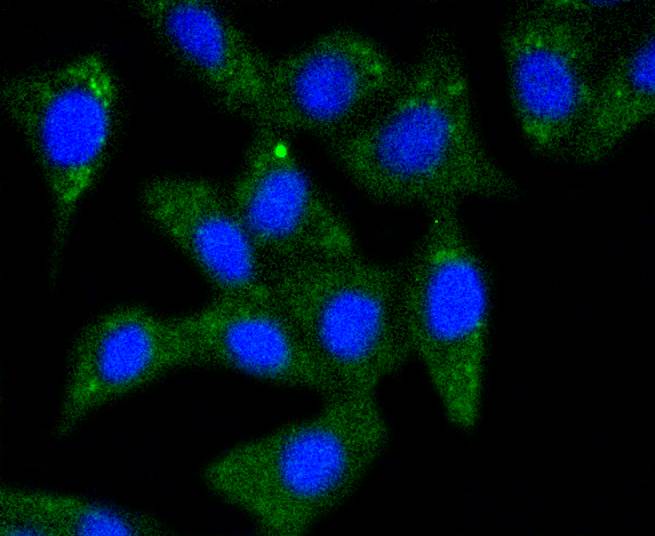 alpha+beta Synuclein Rabbit mAb