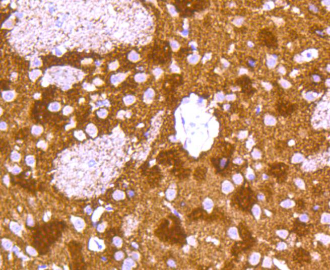 alpha+beta Synuclein Rabbit mAb