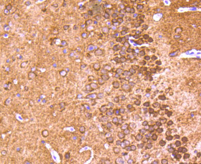 alpha+beta Synuclein Rabbit mAb