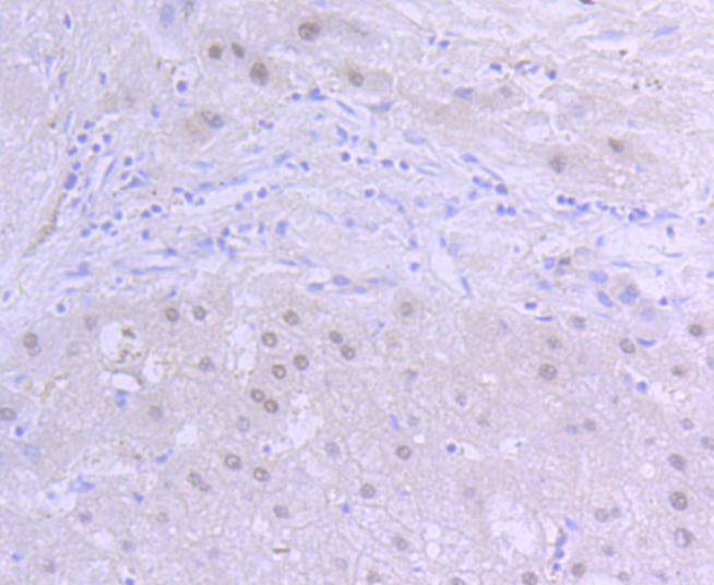 HIF-1 beta Rabbit mAb