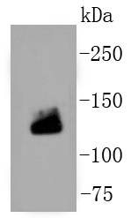 COL1A1/Collagen Ⅰ Rabbit mAb