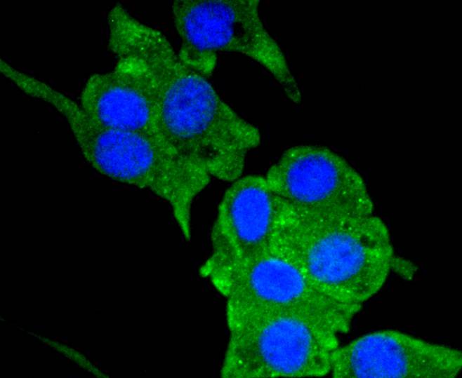 Neuropilin-1 Rabbit mAb