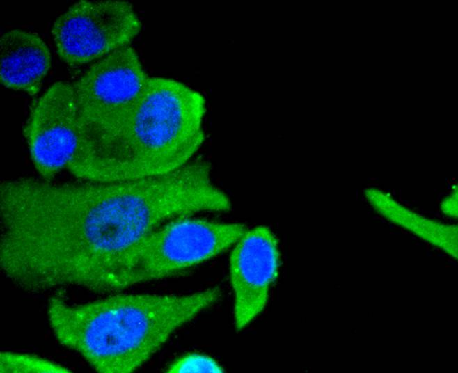 Neuropilin-1 Rabbit mAb