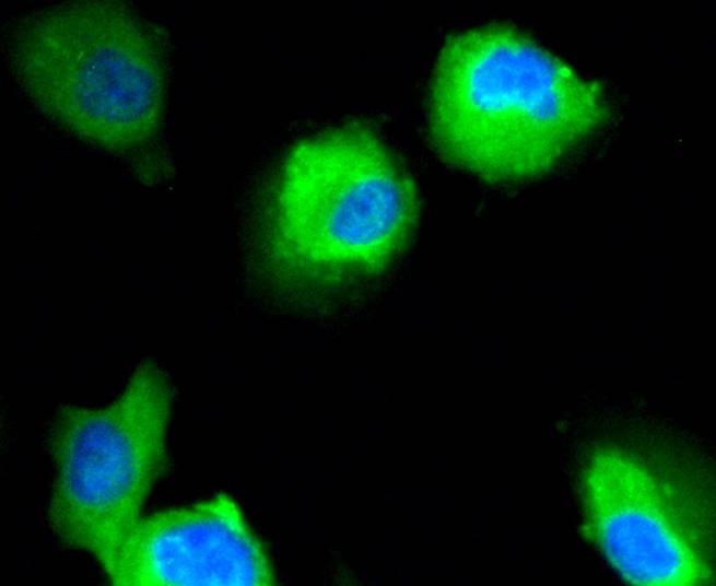 Neuropilin-1 Rabbit mAb