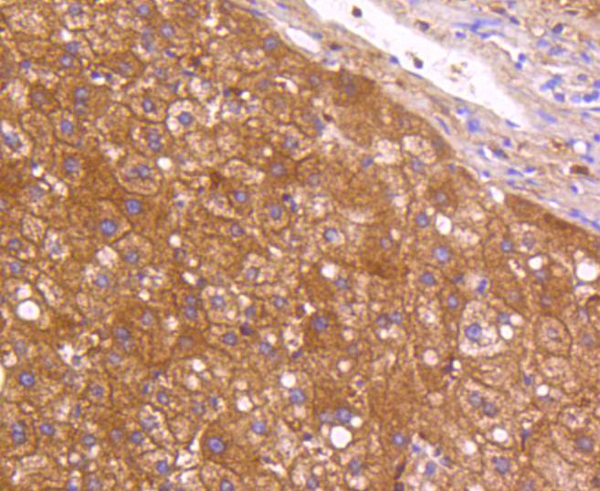 Neuropilin-1 Rabbit mAb