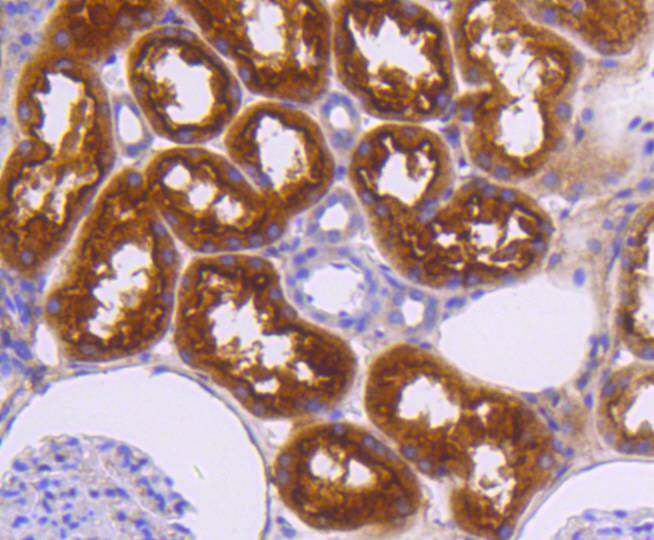 Neuropilin-1 Rabbit mAb