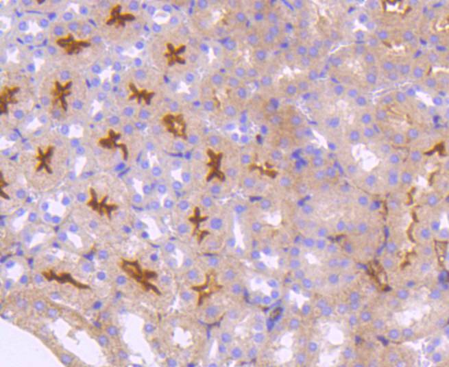 Neuropilin-1 Rabbit mAb