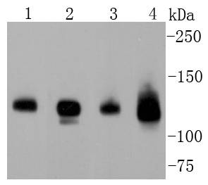 Neuropilin-1 Rabbit mAb