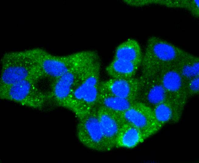 Pan-Cadherin Rabbit mAb