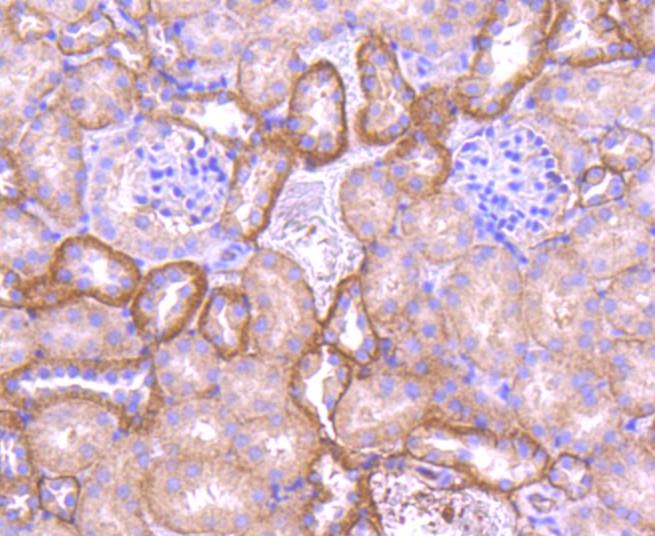 Pan-Cadherin Rabbit mAb